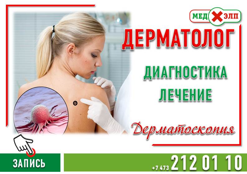 Врач-дерматолог в Воронеже – Медхэлп